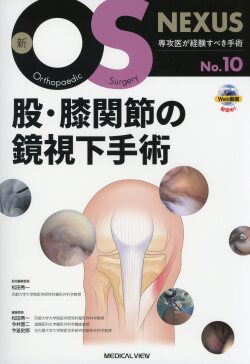 新OS NEXUS　No.10　股・膝関節の鏡視下手術