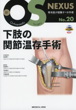新OS NEXUS　No.20　下肢の関節温存手術