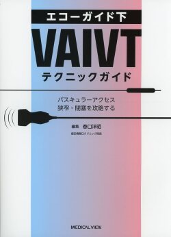 エコーガイド下 VAIVT テクニックガイド バスキュラーアクセス狭窄・閉塞を攻略する