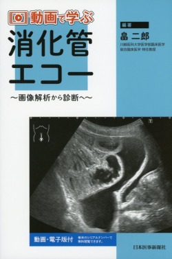 動画で学ぶ消化管エコー ～画像解析から診断へ～