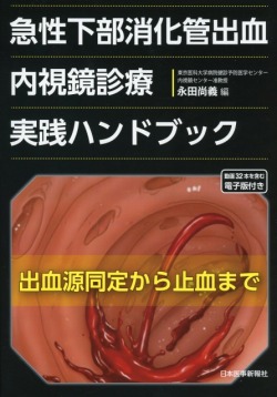急性下部消化管出血　内視鏡診療実践ハンドブック　出血源同定から止血まで