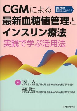 CGMによる最新血糖値管理とインスリン療法