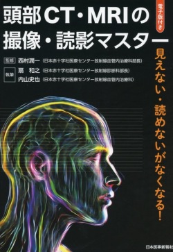 頭部CT・MRIの撮像・読影マスター