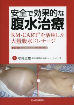 安全で効果的な腹水治療　KM-CART?を活用した大量腹水ドレナージ