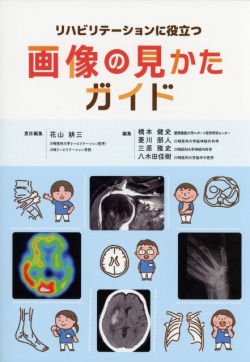 リハビリテーションに役立つ画像の見かたガイド
