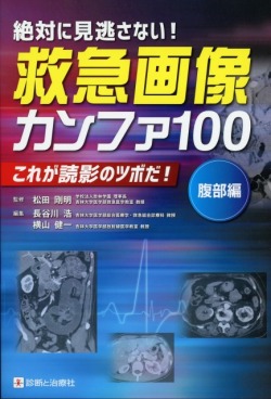 絶対に見逃がさない！ 救急画像カンファ100(腹部編) これが読影のツボだ！