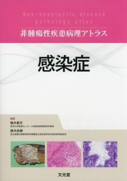 非腫瘍性疾患病理アトラス 感染症