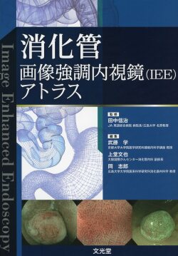消化管画像強調内視鏡(IEE)アトラス
