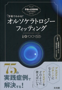 写真でわかる！ オルソケラトロジーフィッティング 学童の近視抑制 お悩み相談室