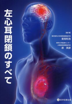 左心耳閉鎖のすべて