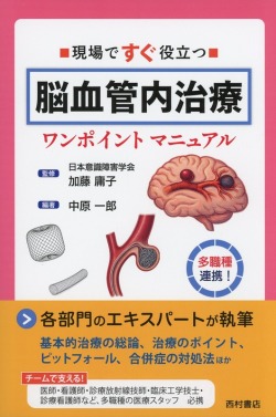 現場ですぐ役立つ　脳血管内治療ワンポイントマニュアル