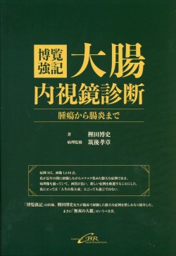 博覧強記 大腸内視鏡診断　腫瘍から腸炎まで