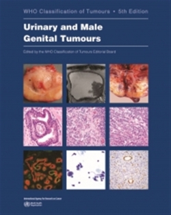 WHO CLASSIFICATION OF TUMOURS, 5TH ED., VOL.8