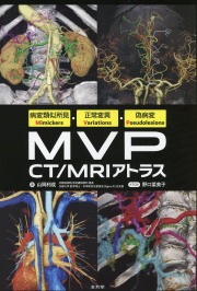 病変類似所見Mimickers・正常変異Variations・偽病変Pseudolesions MVP CT/MRIアトラス