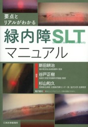 要点とリアルがわかる　緑内障SLTマニュアル