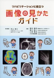 リハビリテーションに役立つ画像の見かたガイド