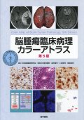 脳腫瘍臨床病理カラーアトラス 第5版 脳腫瘍臨床病理カラーアトラス 第5版 医学書専門店 志学書店