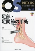 新OS NEXUS No.16  足部・足関節の手術 ［Web動画付］