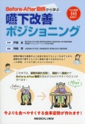 Before-After動画から学ぶ　嚥下改善ポジショニング