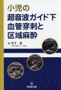 小児の超音波ガイド下血管穿刺と区域麻酔