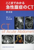 ここまでわかる急性腹症のCT　第4版