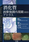 消化管画像強調内視鏡(IEE)アトラス