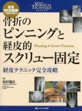骨折のピンニングと経皮的スクリュー固定　経皮テクニック完全攻略