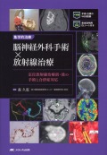集学的治療 脳神経外科手術×放射線治療 定位放射線治療前・後の手術と合併症対応／手術・治療のWEB動画＋患者説明用DLシート付き