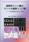 濾胞性リンパ腫とマントル細胞リンパ腫　リンパ球系腫瘍の基本と展開