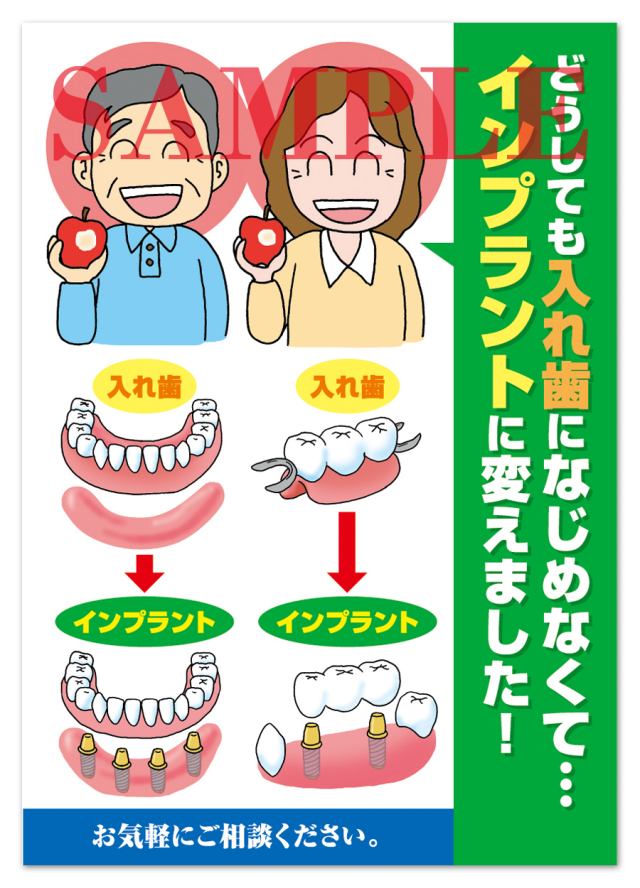 POS008　インプラントＰＲ用ポスター（A3サイズ）