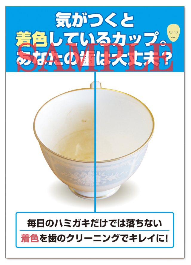 POS020　歯の着色は大丈夫？ポスター（A3サイズ）