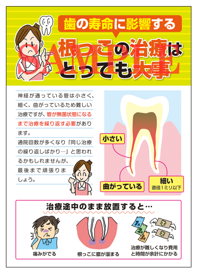 根管治療