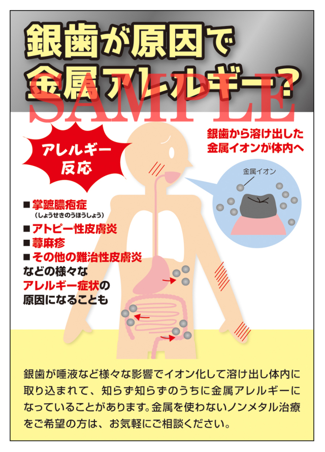 歯科金属アレルギー
