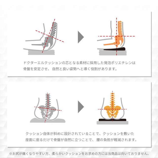 ドクターエルクッションの使用後