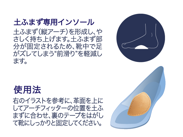 アーチフィッター