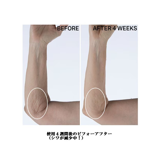 ] StriVectin Crepe Control Tightening Body Cream 2