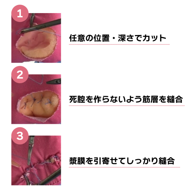 LM縫合モデルキット (Pタイプ)】