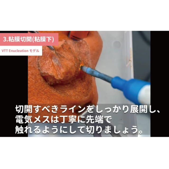 VTT-Enucleation model【VTT-ENU-model】 腹腔鏡トレーニングボックス