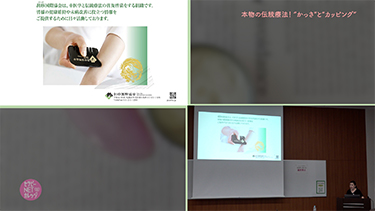【TNCC】雲瑶の本物の伝統療法！ “かっさ”と“カッピング”