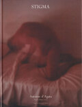 Antoine d'Agata: Stigma