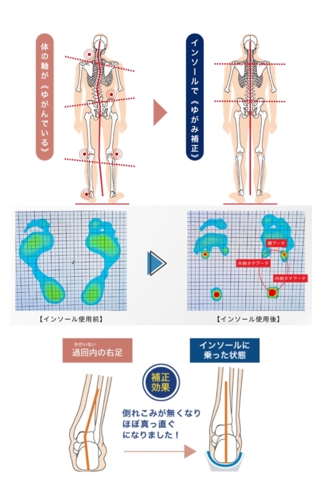 みんなインソール
