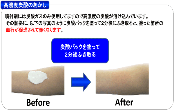夢・彩華炭酸パック