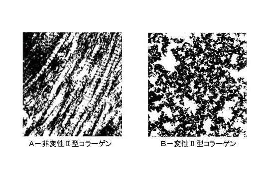 コラーゲンには、2つのタイプがあります。